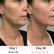 ELMIRA SKIN 7-in-1 LED Facial Sculptor