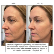ELMIRA SKIN 7-in-1 LED Facial Sculptor