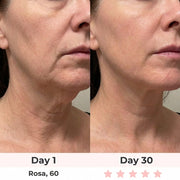 ELMIRA SKIN 7-in-1 LED Facial Sculptor