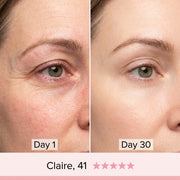 ELMIRA SKIN 7-in-1 LED Facial Sculptor